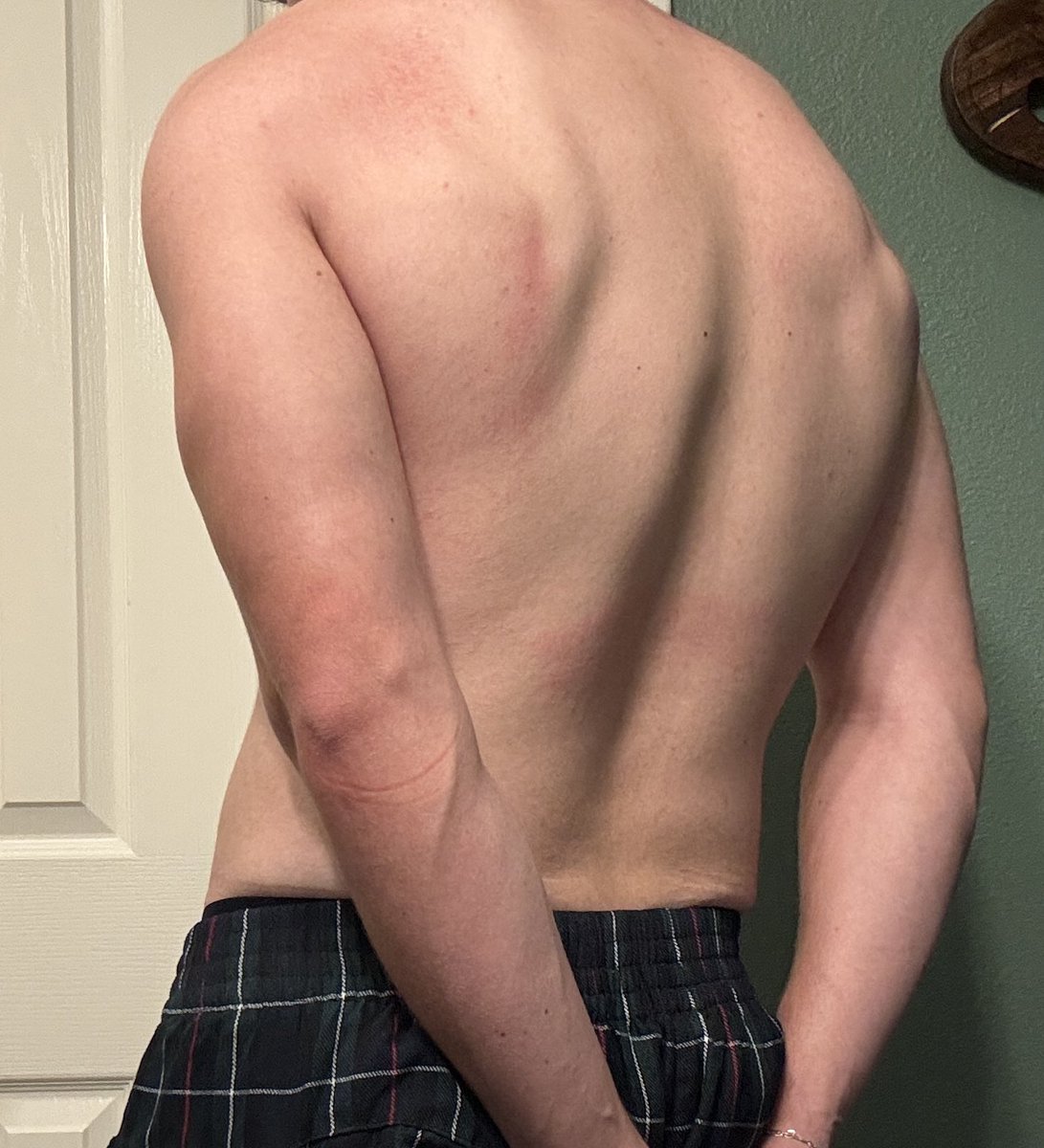 back looking bigger😫