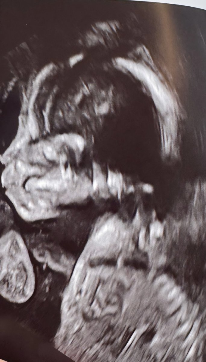 USDT손손직거래[구글도배,구글찌라시 텔 𝑮𝑺𝑬𝑶8]텔레그램OTC.bxa