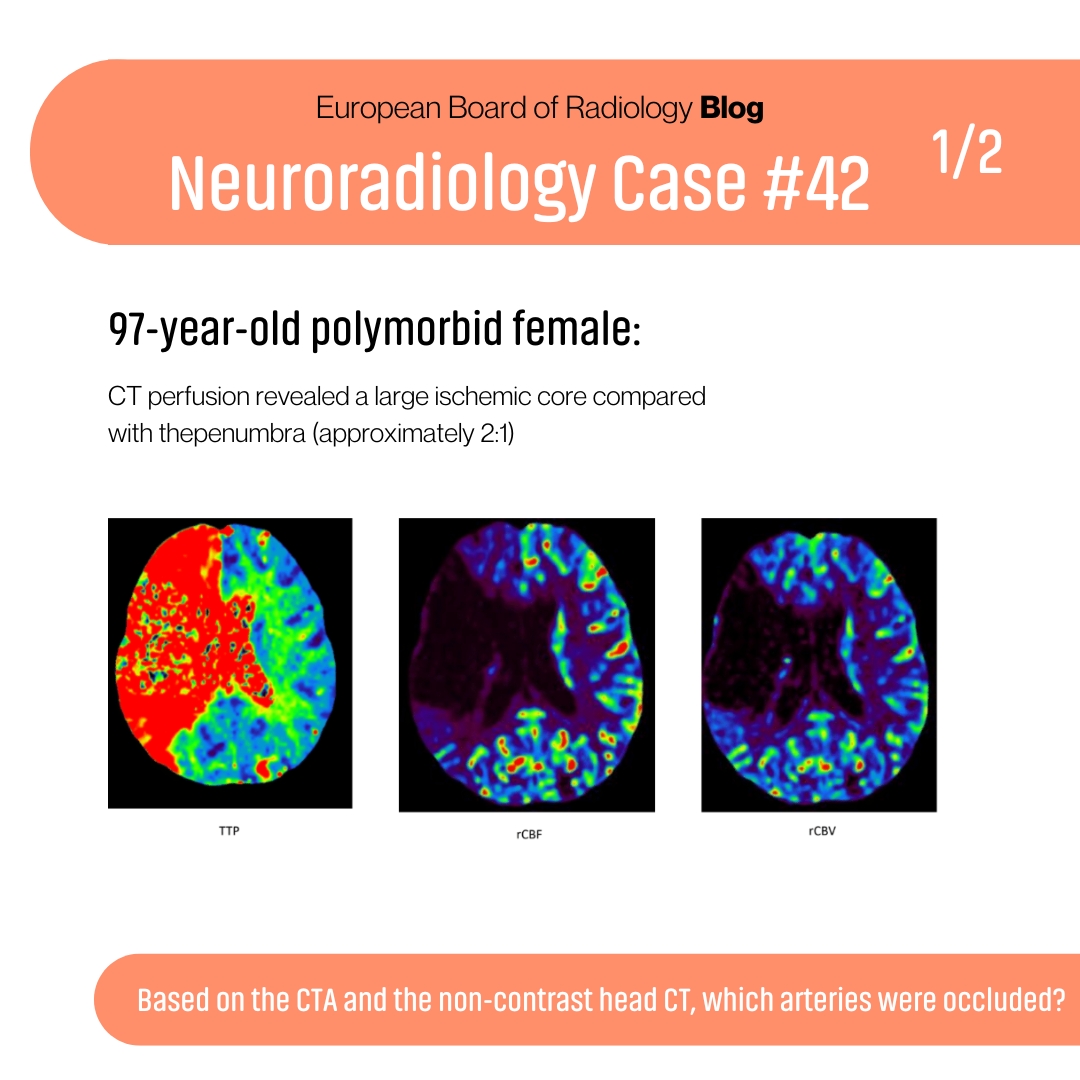 EuropeanBoardRadiology tweet media