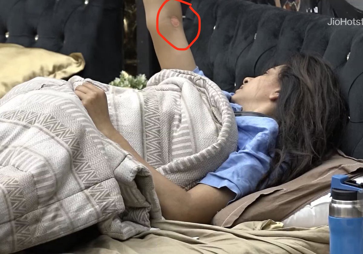 DtbDivya's tweet image. Divya was unwell. She took strips and still blood strains are there.
Despite she is playing task and doing cooking for everyone

But some group want Divya to get down from car and carry Sandra to medical room🤦‍♀️

Stay strong Divya ❤️ already you gave your best #BiggBossTamil9