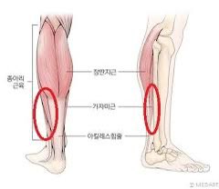 z9_s8_y_9's tweet image. **'지치지 않는 무한 혈당 청소기'**

스쿼트보다 쉬운데, 혈당은 더 잘 잡는다고? (feat. 가자미근)

[1/6] 🩸 밥 먹고 스쿼트 하지 마세요. 

'앉아 계세요'.
혈당 잡으려고 식후에 억지로 허벅지 운동하시나요?

더 쉽고, 더 강력하고, 절대 지치지 않는 근육이 있습니다.

바로 종아리 속근육,…