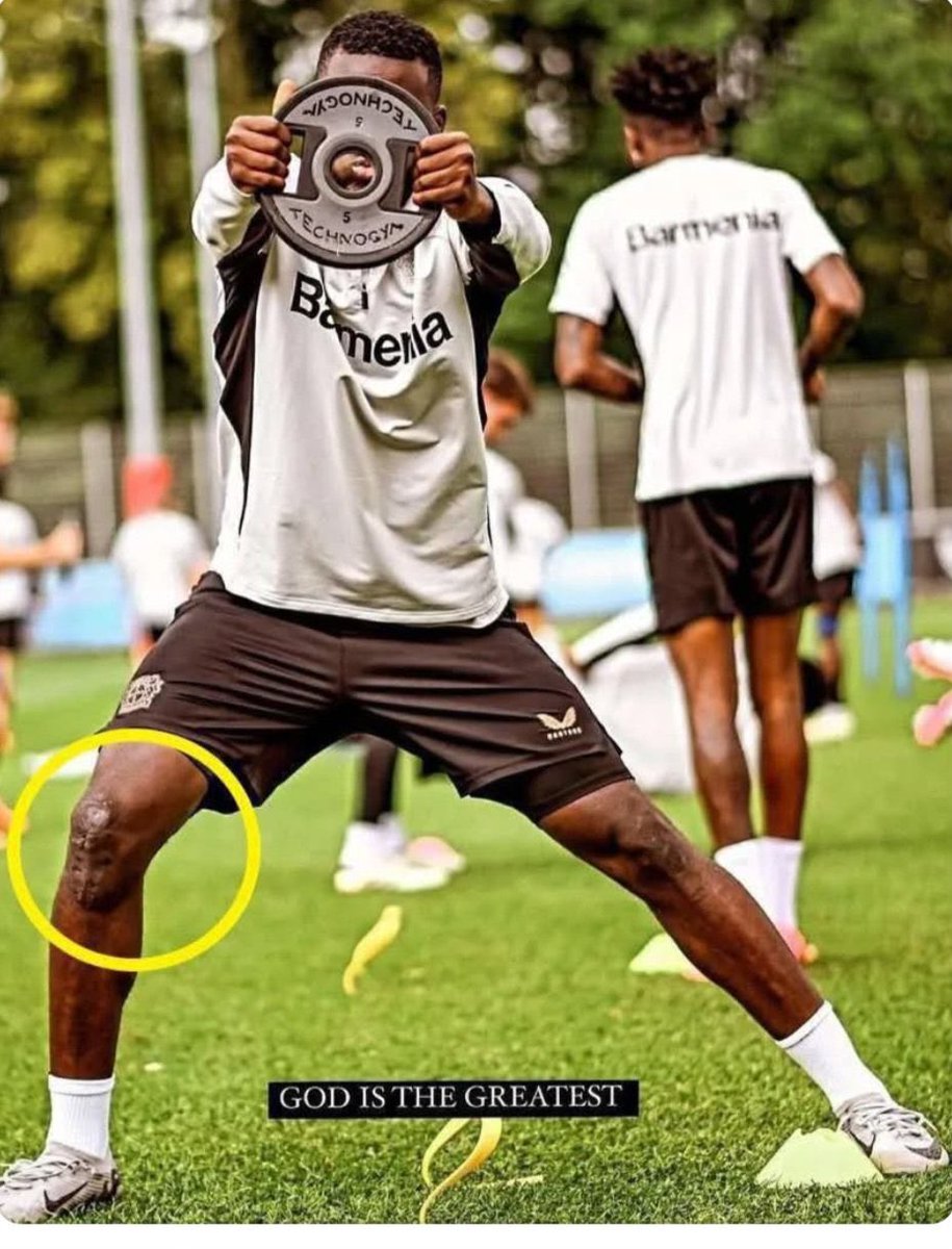 afrikafutbolu1's tweet image. 🚨 Victor Boniface, 25 yaşında futbolu bırakabilir!

➖ Oyuncunun dizinden ameliyat olması gerekiyor, olursa sezonu kapatacak.
➖ Werder Bremen ise bu şekilde asla oynatmıyor. Tekrar sakatlanır ise geri dönüşü olamayabilir.

2 kere de çapraz bağ yırtan Boniface, çökmüş durumda.