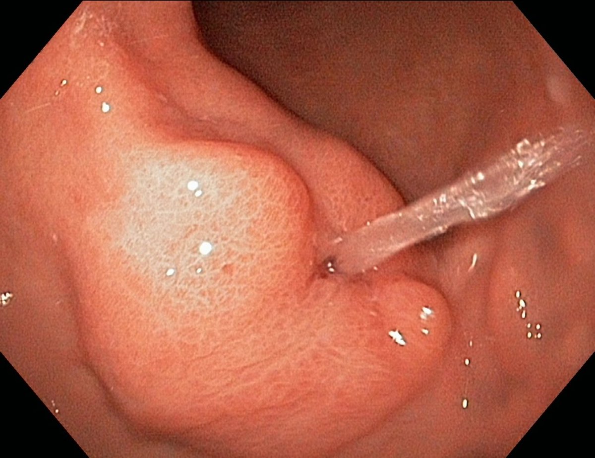 Keith Siau tweet media