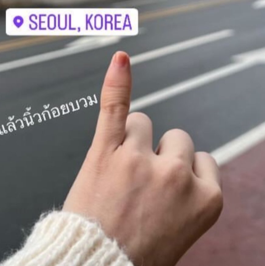 heyiammuay's tweet image. มาเบลนิ้วบวมทุกปี อากาศแกล้งนิ้วชีตลอดเลย