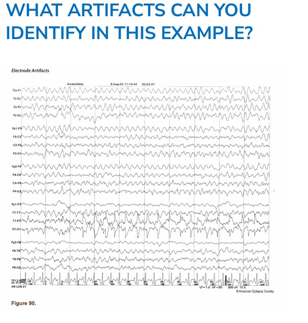 Compumedics tweet media
