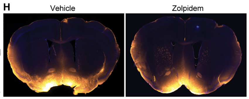 Finding #4: Zolpidem (Ambien) is a problem.
It helped mice fall asleep faster but suppressed the norepinephrine oscillations.

Result: Significantly reduced brain cleaning compared to natural sleep.