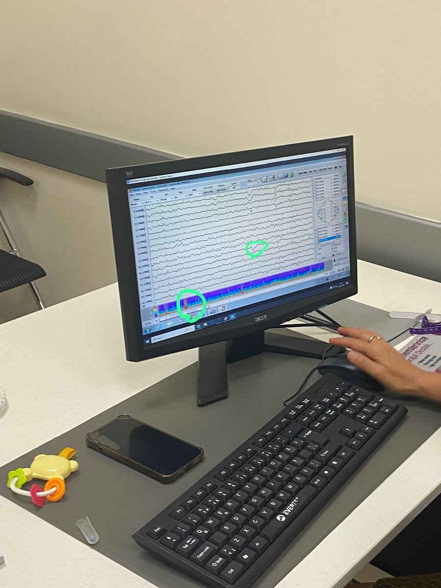 çocuk nörolojiyle başlayıp 3.5R ile biten gün
10/10
popeyes yiyip şöyle uyumayı hak ettim.