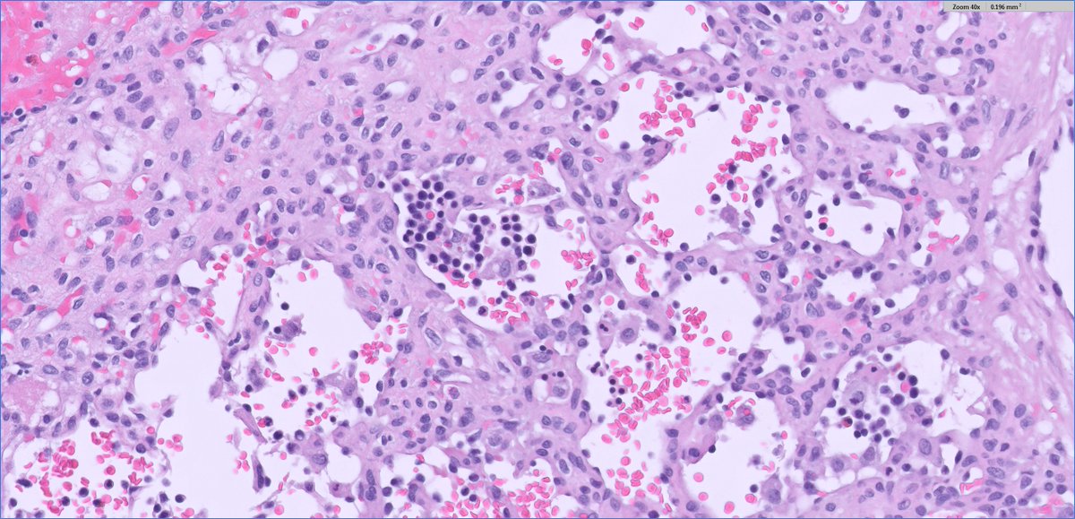 Ankur Sangoi tweet media