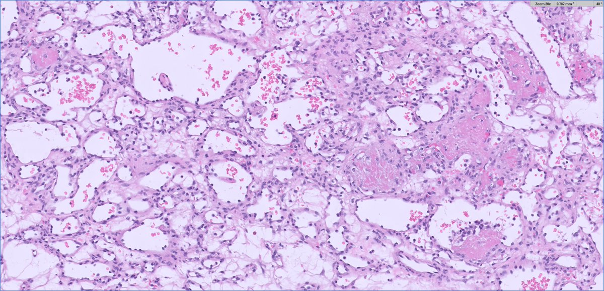 Ankur Sangoi tweet media