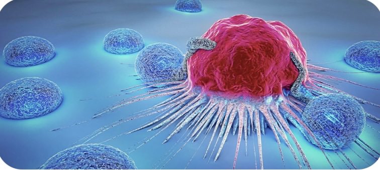 Kanser asidik ortamları sever; bu nedenle hangi yiyeceklerin vücudu asidik hale getirdiğini bilmek önemlidir.

Kanser düşük oksijenli ortamları sever; bu yüzden egzersiz yapın/yürüyün.

Kanser yüksek glikoz/şeker seviyelerini sever; bu nedenle aralıklı oruç tutun ve işlenmiş,