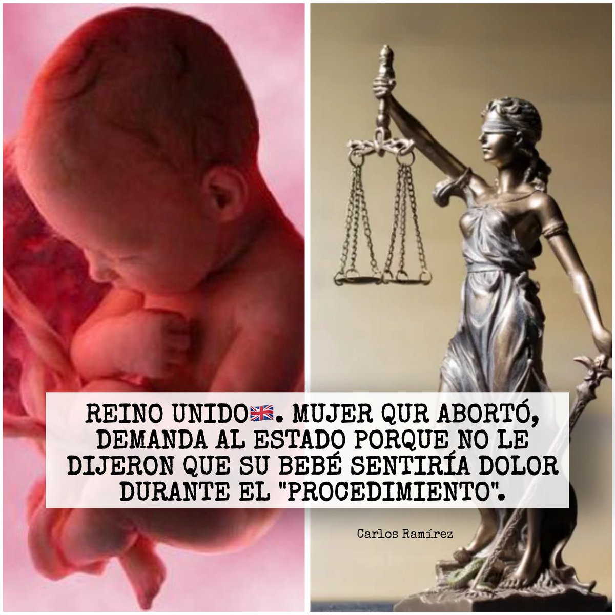 CarlRamirezA's tweet image. ¿TE ENTERASTE? 🚨

Una mujer que se sometió a un aborto en Reino Unido, presentó una demanda contra el Estado, porque afirma que no se habría realizado esta práctica, si le hubiesen informado que su hijo de 23 semanas de gestación sentiría dolor durante el procedimiento.

"No me…