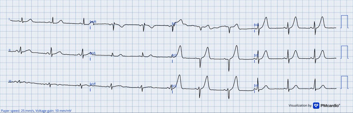 Jack Cahill tweet media