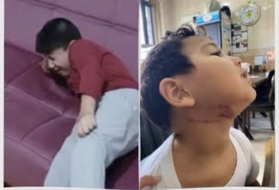 Selman 4 yaşında.

Verem oldu, durumu kritik, iyileşmiyor.

Annesi Melek ve babası Yusuf İpek Edirne Cezaevi’nde. 

İhsan 8 yaşında %95 engelli,her gün ağlıyor. Annesiz yaşayamaz.
Annesi Venhar Can Eskişehir cezaevinde.

İhsanVeSelman AnneyeMuhtaç

<a href="/adalet_bakanlik/">T.C. Adalet Bakanlığı</a> 
<a href="/yilmaztunc/">Yılmaz TUNÇ</a>