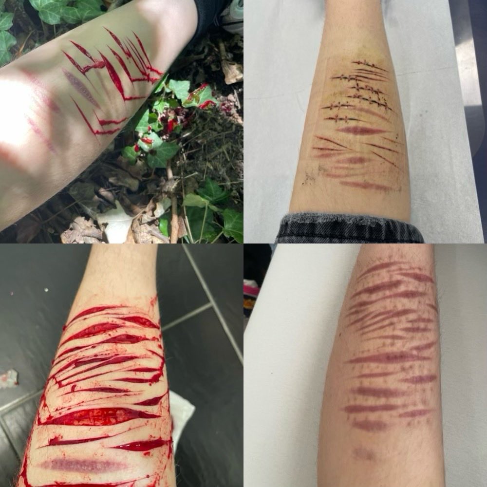 v_4l3t's tweet photo. cuts vs. scars on calf
i hat the shrinkage sm
#slitwt #shtwt #shedtwt #beanshtwt https://t.co/dJ3rL5Ruca