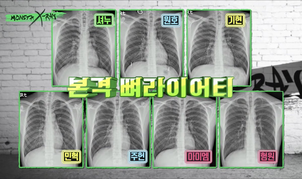 junoxbebe's tweet image. so i started rewatching monsta x-ray and i totally forgot they had these men get actual chest x-rays in ep 1 like what even 😭