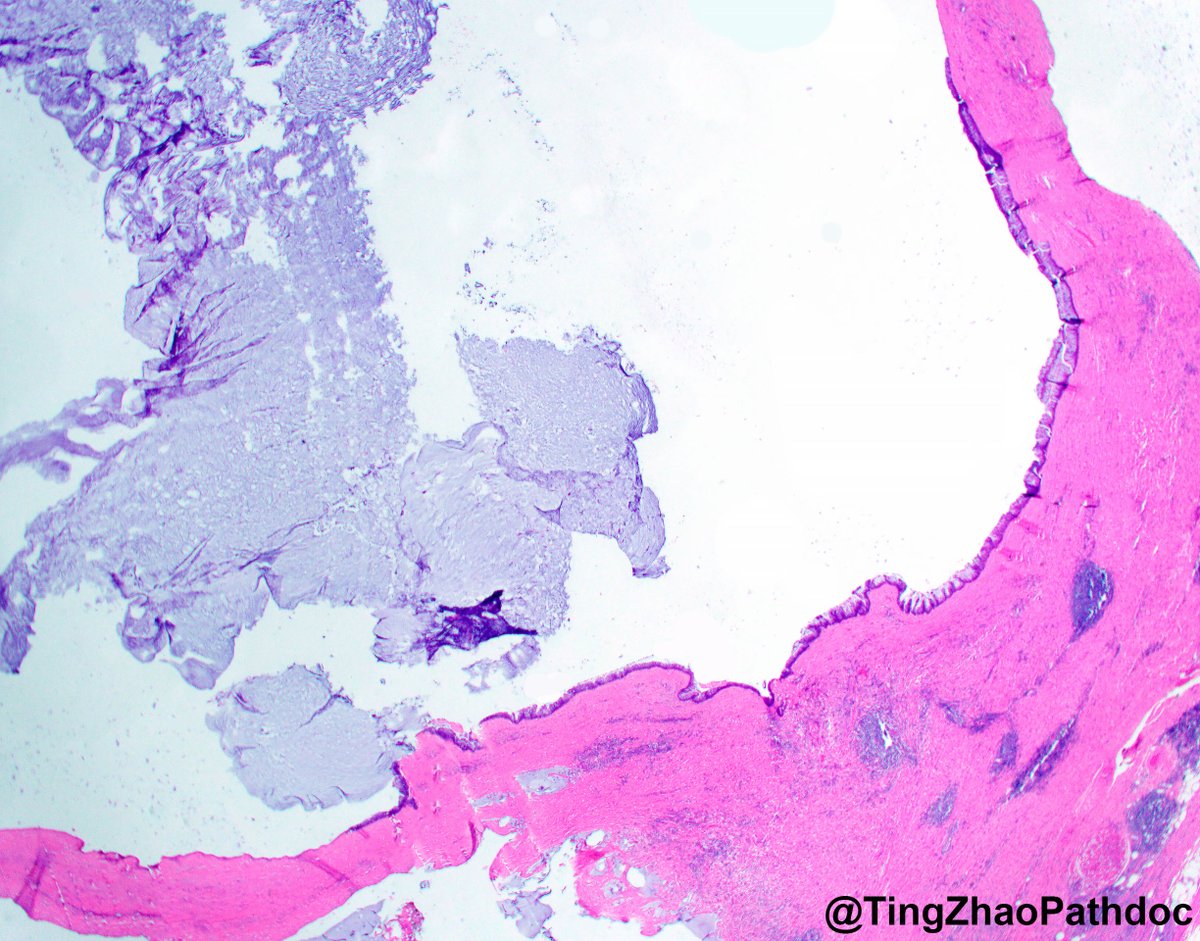 Ting Zhao, MD tweet media