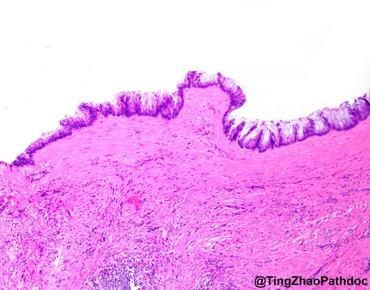 Ting Zhao, MD tweet media