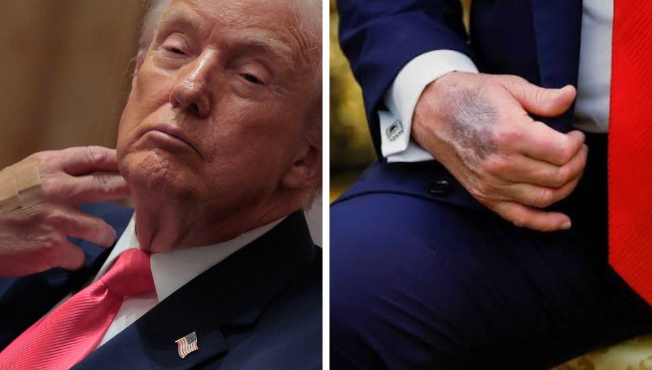 Trump admite que ignora recomendaciones médicas y consume más aspirina de lo sugerido. La declaración genera debate sobre su salud. #Salud
🔗 Lee más: eltabasqueno.com/trump-ignora-c…
