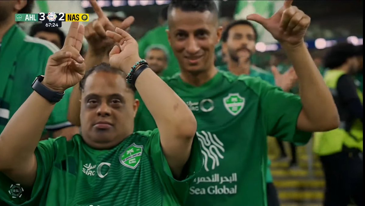 My first time seeing a down syndrome saudi