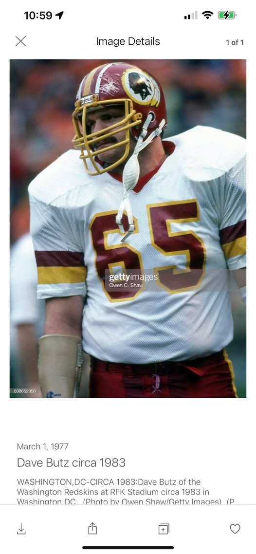 discoque90's tweet image. The greatest "Hold My Beer" story ever.

In 1987, Dave Butz was in the hospital for an intestinal virus.  He checked himself out of the hospital for a game against the Jets and recorded the game saving sack, and then checked himself back into the hospital.