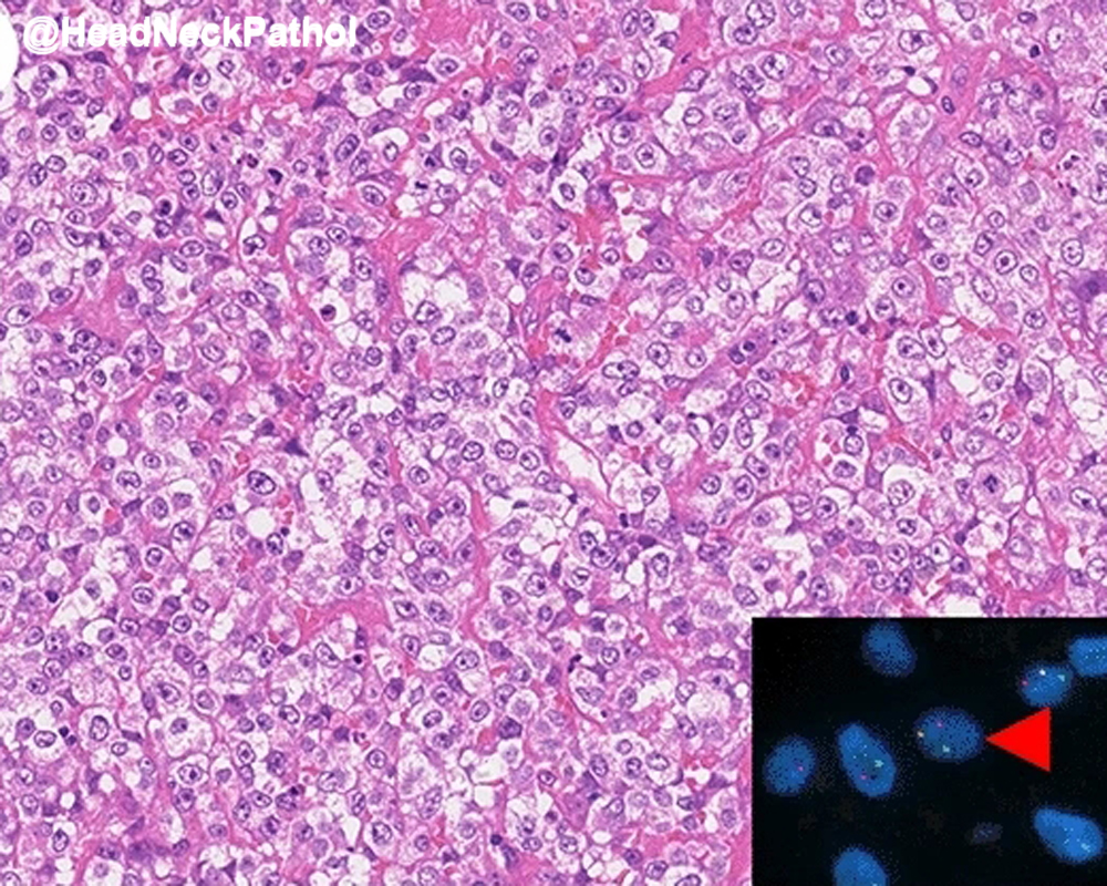 Head Neck Pathol tweet media