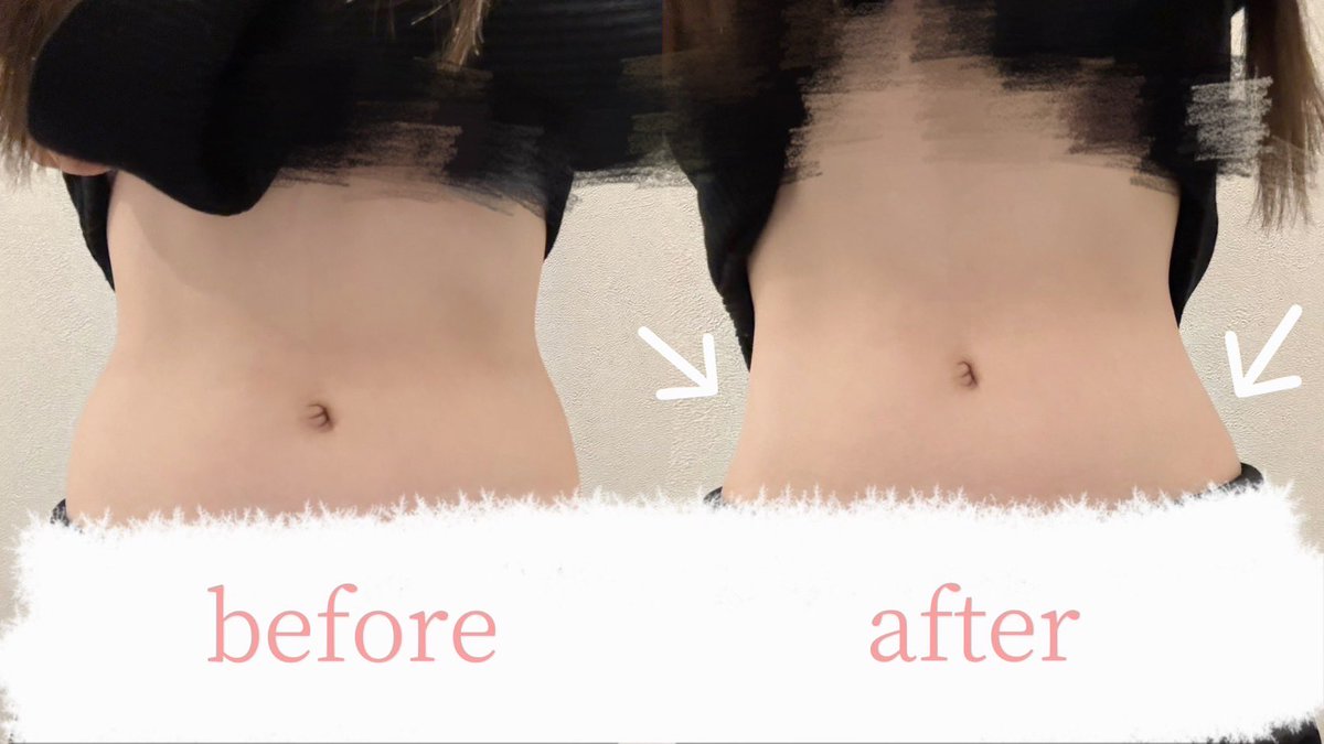 公式】プランエスクリニック（PLAN;SCLINIC） (@plansjp) / Posts / X