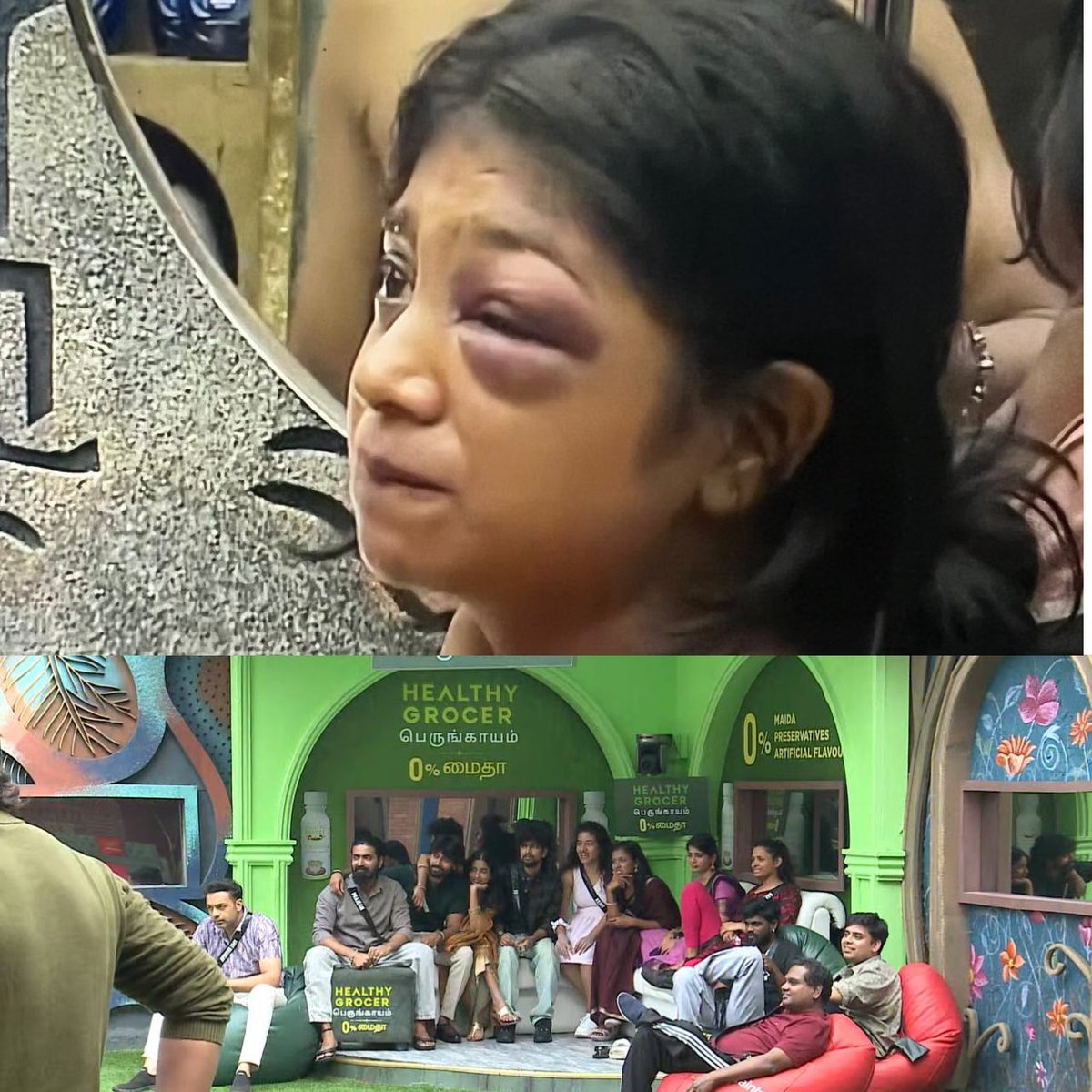 When it came to VJ Parvathy (orbital contusion)the entire house remained silent. No one stepped forward except Kamrudin and Diwakar.

But when Sandra acted, everyone rushed to defend her.

“காரணம் Sandra மீதான அன்பு அல்ல; பார்வதி மீதான வன்மம் “

#BiggBossTamil9 #BiggBossTamil