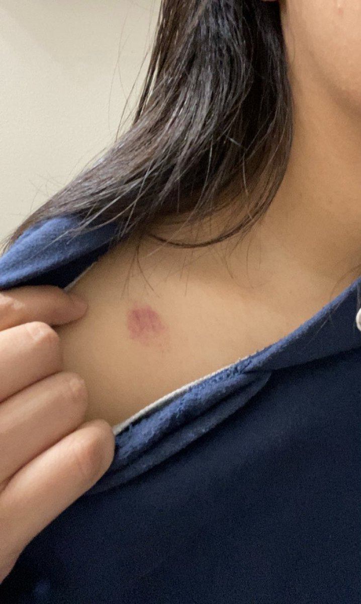 _kitty1cat's tweet photo. Chat… i got my first hickey https://t.co/iIZTYC8fZ0