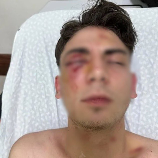 darkwebhaber's tweet photo. Konya’da 18 yaşındaki bir genci muştayla döverek bir gözünü kaybetmesine neden olan iki kişi, cezaevinde 1,5 ay kaldıktan sonra tahliye edildi. 

Tahliye sonrası poz veren ikili: “Birimiz erken çıktı, birimiz geç ama aynı suç, aynı kader; dışarısı şimdi şahidimiz” https://t.co/0bfaOnysrz