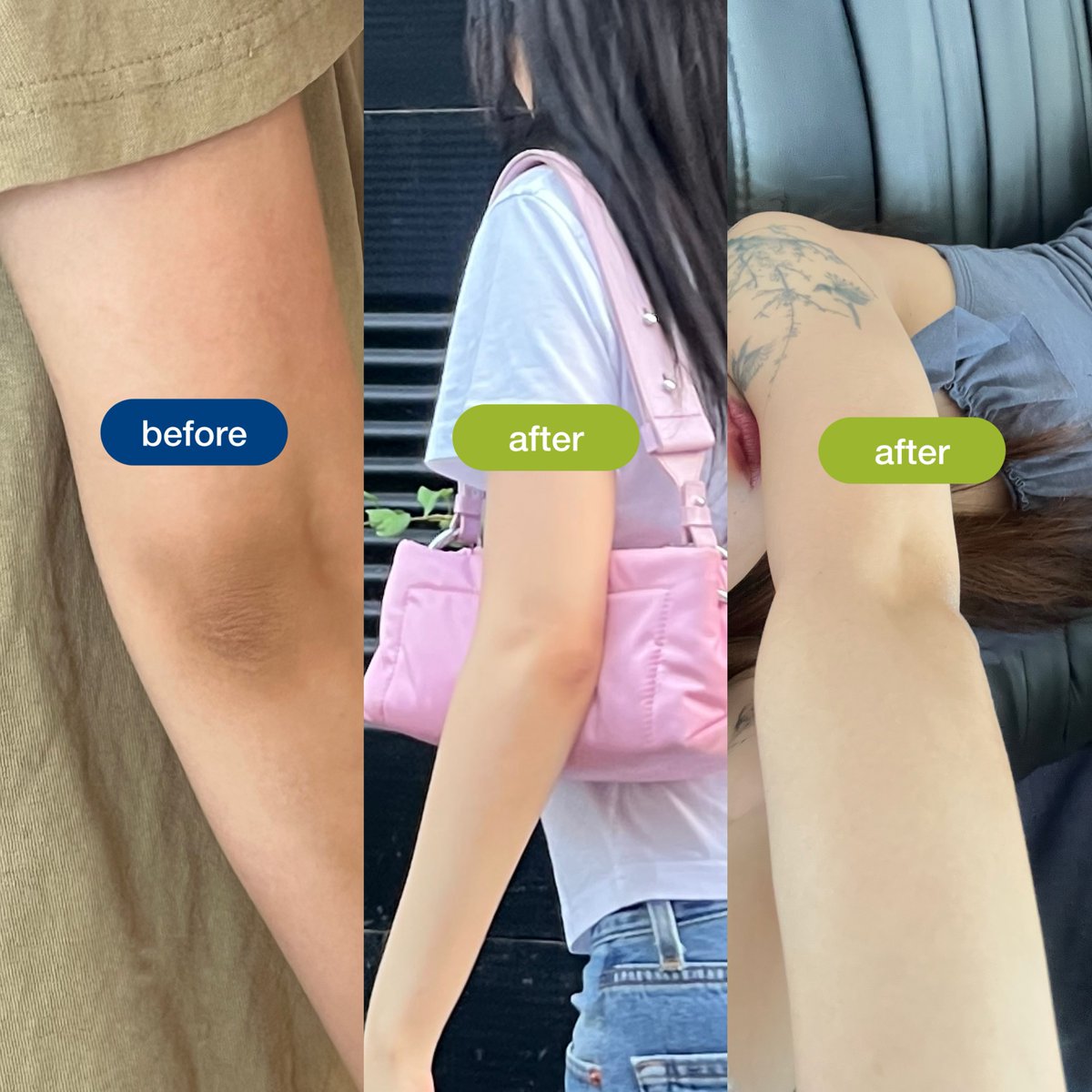 bubuxing's tweet photo. The ordinary glycolic acid 7%
ใช้บ้างไม่ใช้บ้างมาหลายปีไม่เคยติดโผ เพราะเราใช้กับหน้าไม่ได้เลย เละ ปีก่อนๆเลยเริ่มเอามาใส่สำลีเช็ดทำความสะอาดใบหู หลังหู เช็ดคอ ศอก เข่า แกเอ๊ยยย คือตรงไหนดำๆด้านๆ ขี้ไคลเยอะ เช็ดได้เลยหลังอาบน้ำ อยากให้ทุกคนมีติดบ้านเลยอะมันสารพัดประโยชน์ หยดใส่หัวก็ลดความมันผมได้ น้ำอัมฤทธิ์เลยยังได้ไปต่อกับพี่ในปีนี้อีก ระเบิดขี้ไคลตู้มแตก จบๆ
