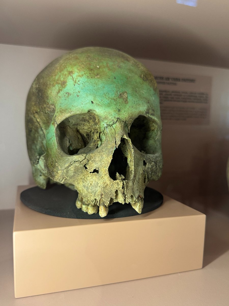 Skelets Gastons tweet media