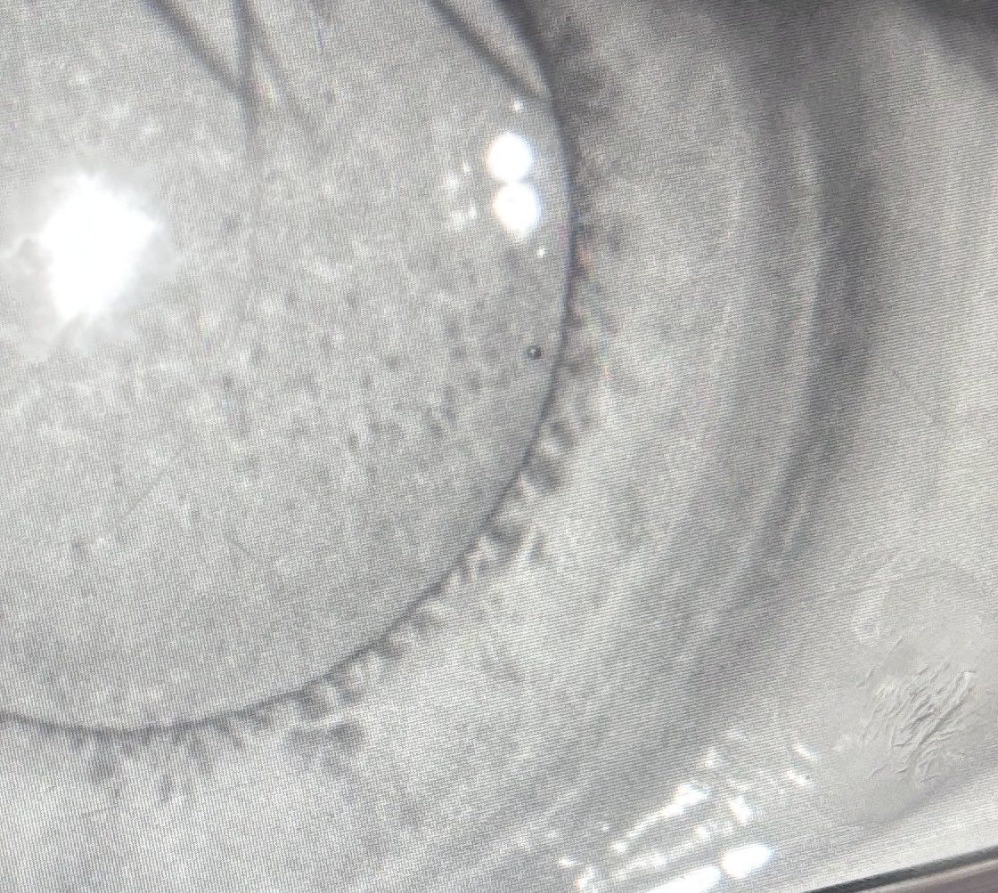 ตอนรับปีด้วยการเสี่ยงเป็นมะเร็งตา🌷💀