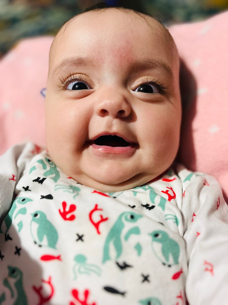 Aquí con ustedes.
La hermosa Sofía.!!
RT para que se haga viral.
Craneosinostosis lamboidea bilateral 
Necesita operación urgente.!!
🆘🆘🆘
Ella es mi hija Sofía