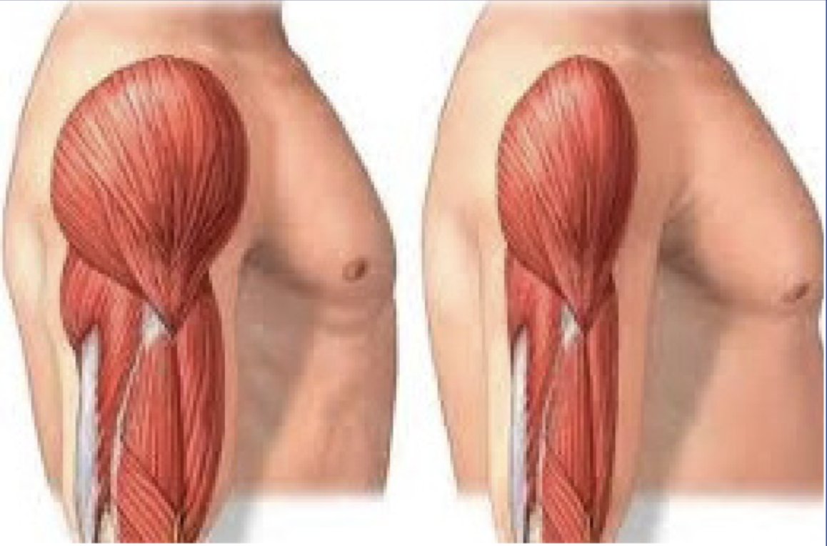 You start losing muscle at 30.

By 40, it’s 1% per year.

By 70, most men lose up to 50% of their muscle mass.

This is why you feel:
→ Slower
→ Softer
→ Weaker

The fix? 

Here’s how to reverse sarcopenia and stay strong after 40. No guesswork: (Bookmark this!) 👇