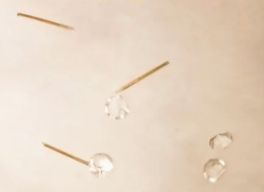 Susuk merupakan salah satu budaya klenik paling populer. Banyak yang pakai, mungkin juga teman atau kenalan kamu. Ini cerita tentang susuk yang ditanam di kemaluan.