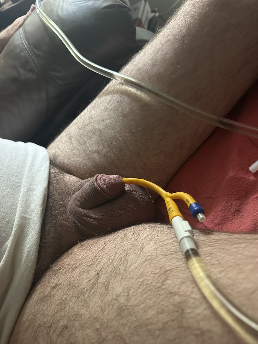 lockedinnd's tweet photo. Pur in a 22 on Thursday but had to pull that one Friday afternoon because the spasms were terrible. Got home last night after a couple drinks and a shower and put in a 24, so far so good! #cathplay #foleycatheterplay https://t.co/aJEOfokCEx