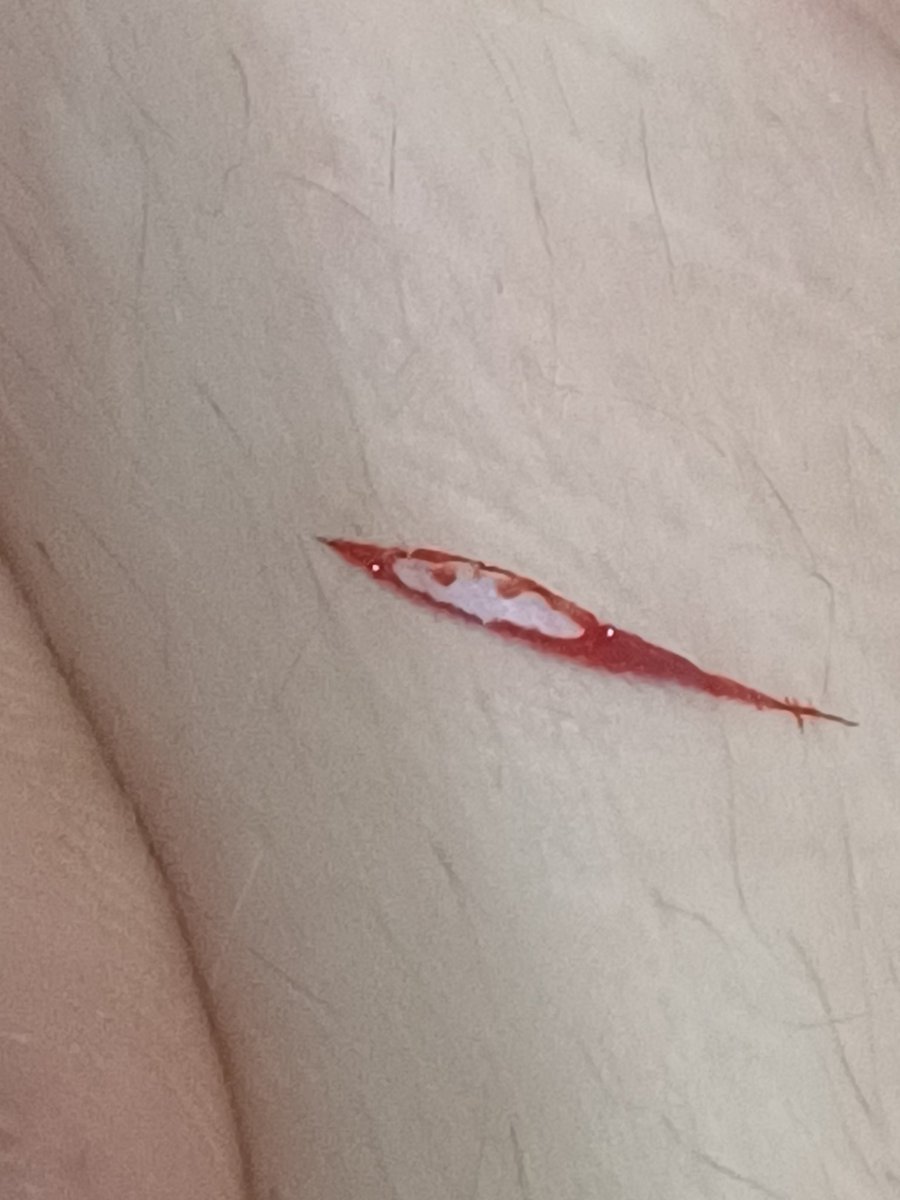 sufferingpear's tweet photo. Lil styro https://t.co/ztW6dBLvrT