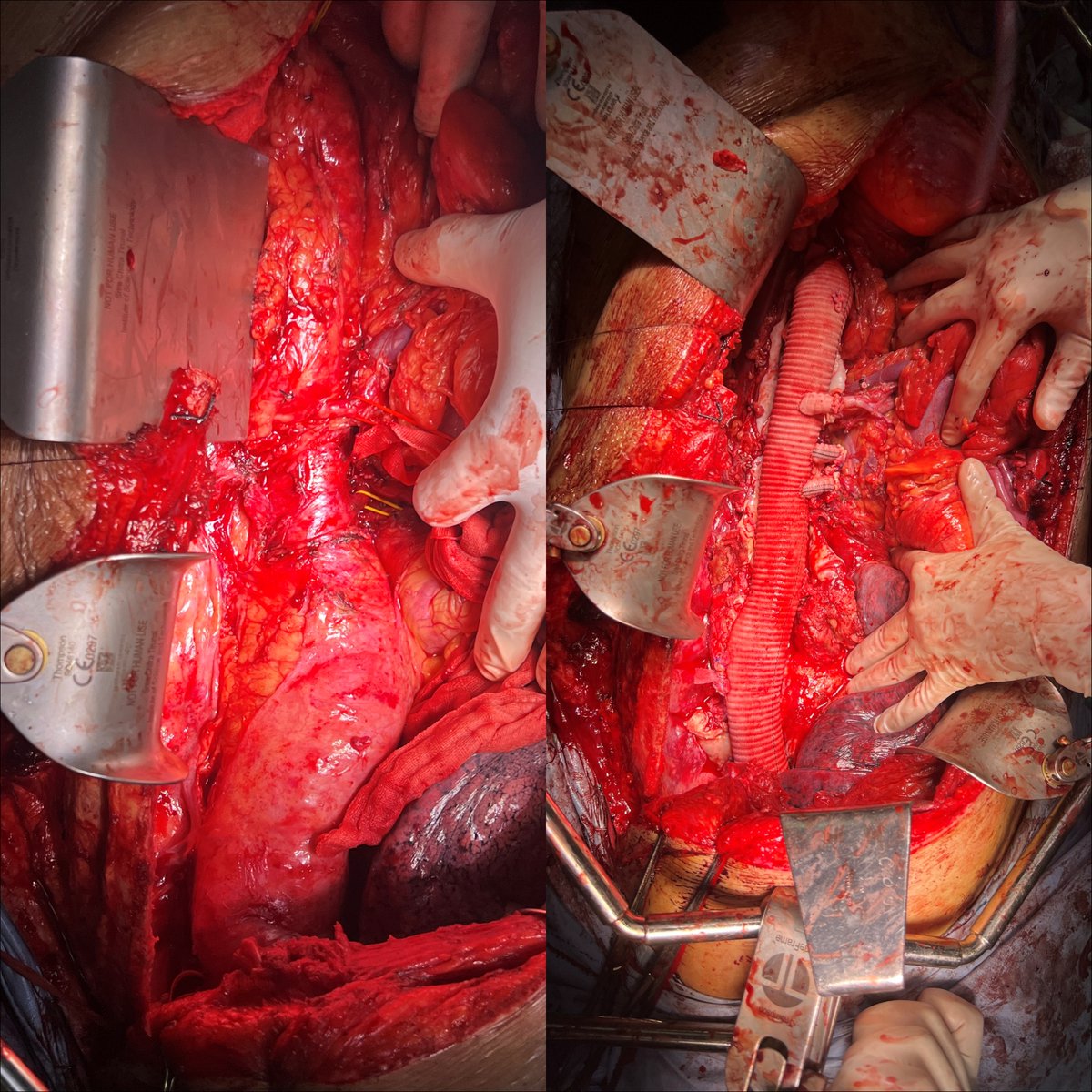 Dr Shivanesan Pitchai tweet media