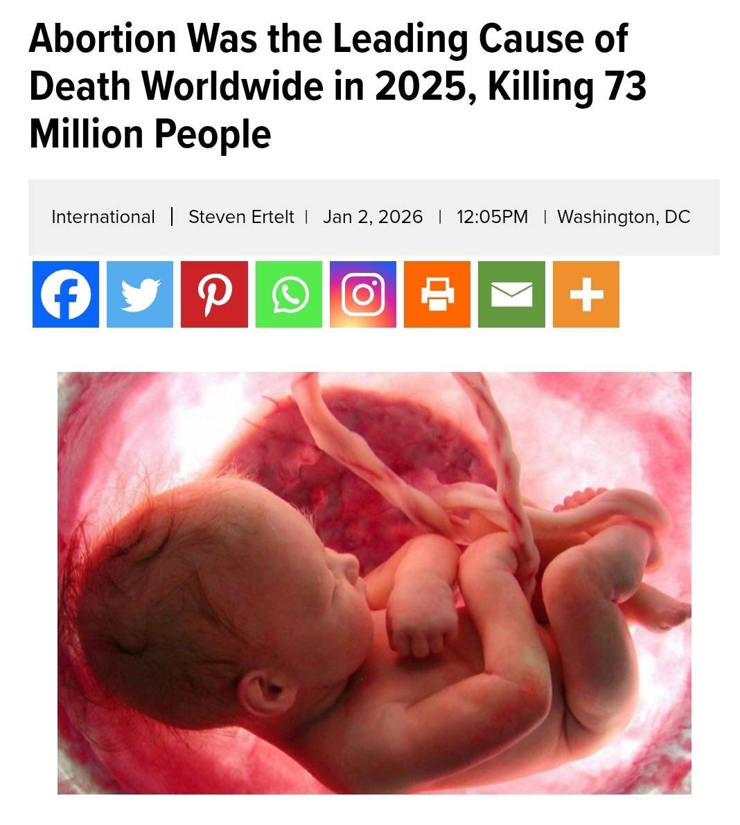 SleeplessBKKNew's tweet image. รู้หรือไม่ว่าในปี 2025 ที่ผ่านมา “การทำแท้ง” เป็นสาเหตุอันดับหนึ่งของการเสียชีวิต

- มีมนุษย์เสียชีวิตจากการทำแท้งถึง 73 ล้านคน
- เสียชีวิตจากโรคหัวใจและหลอดเลือด ประมาณ 20.5 ล้านคน
- โรคมะเร็ง ประมาณ 10 - 10.4 ล้านคน
- อุบัติเหตุทางถนนประมาณ 1.2 ล้านคน