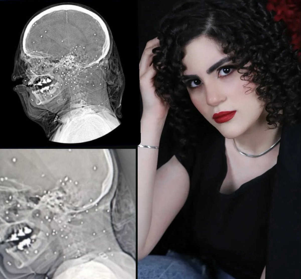 GhorbaniiNiyak's tweet photo. 🚨 URGENT – FARSAN, IRAN

Saghar E’temadi, 22, has died after being shot by terrorist regime security forces.

Saghar E’temadi, a young resident of Farsan, was critically injured in the head by shotgun pellets fired by regime forces during the nationwide uprising.

She succumbed to his injuries and passed away in hospital.

CC: @realDonaldTrump @POTUS @marcorubio