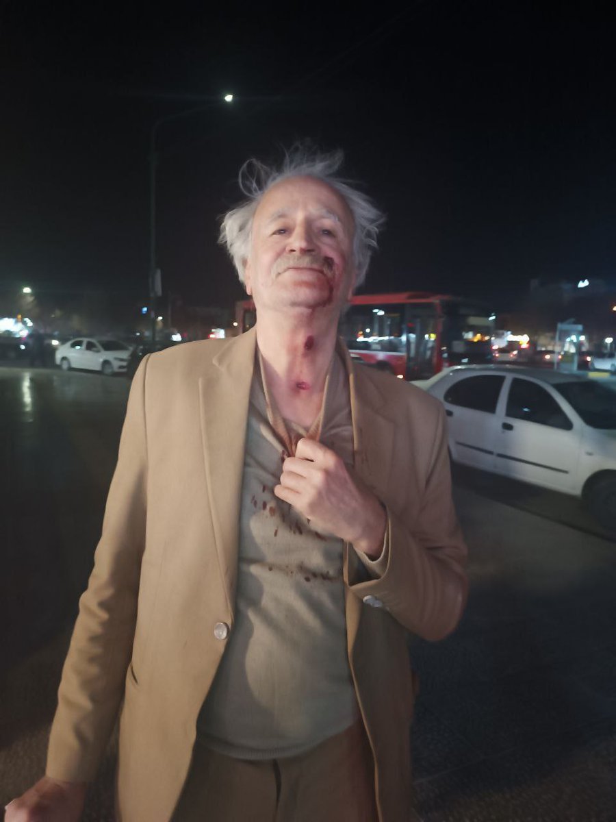 🚨اصفهان | شنبه ۱۳ دی ۱۴۰۴/نیروهای سرکوبگر رژیم تروریستی جمهوری اسلامی با شلیک ساچمه به‌سوی معترضان، یک پیرمرد بی‌دفاع را هدف قرار دادند. این اقدام شنیع نه تنها نشان‌دهنده وحشیگری رژیم در سرکوب مردم است، بلکه بی‌رحمی و بی‌اعتنایی به جان انسان‌ها را در برابر اعتراضات مشروع مردم به