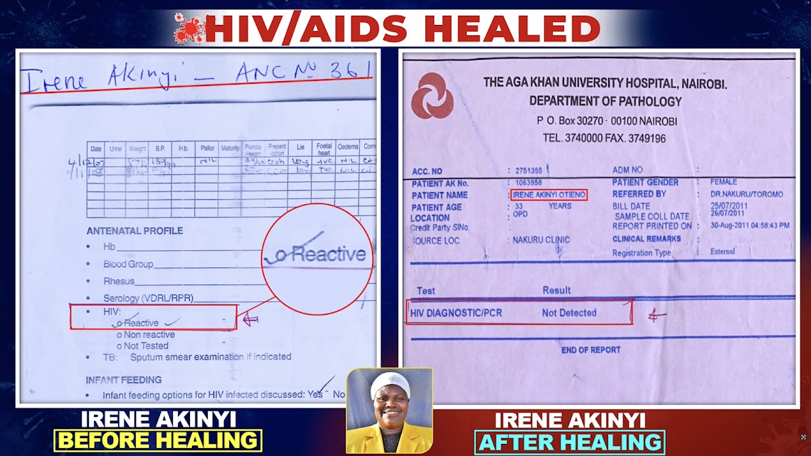 Prophet_DrOwuor's tweet image. Given that we have extensive medical documentation spanning numerous cases, we're calling on the Government of Kenya, through the Ministry of Health and the KMPDC, to conduct a thorough, formal investigation of these documented healings. We're not asking for blind acceptance.…