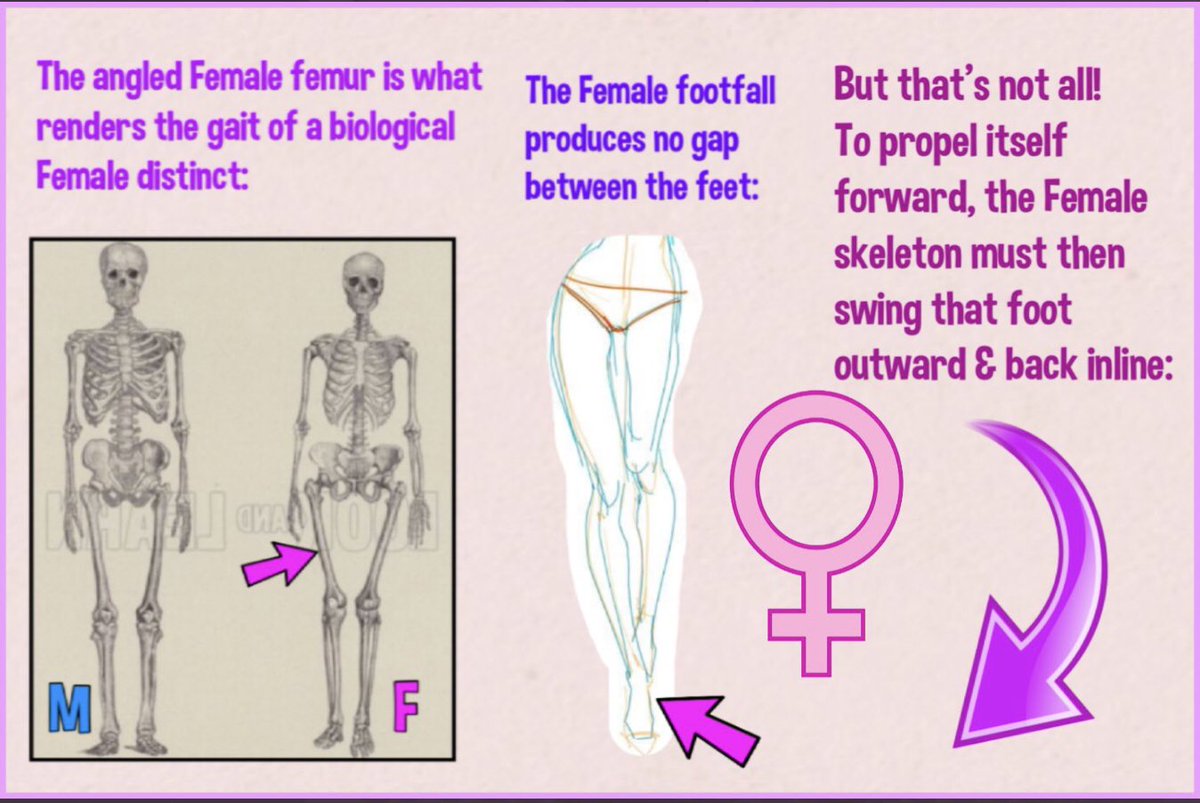Silo1986's tweet image. another psyop BS! 💩

Nicolás Maduro is biologcal woman ⚧️🏳️‍⚧️