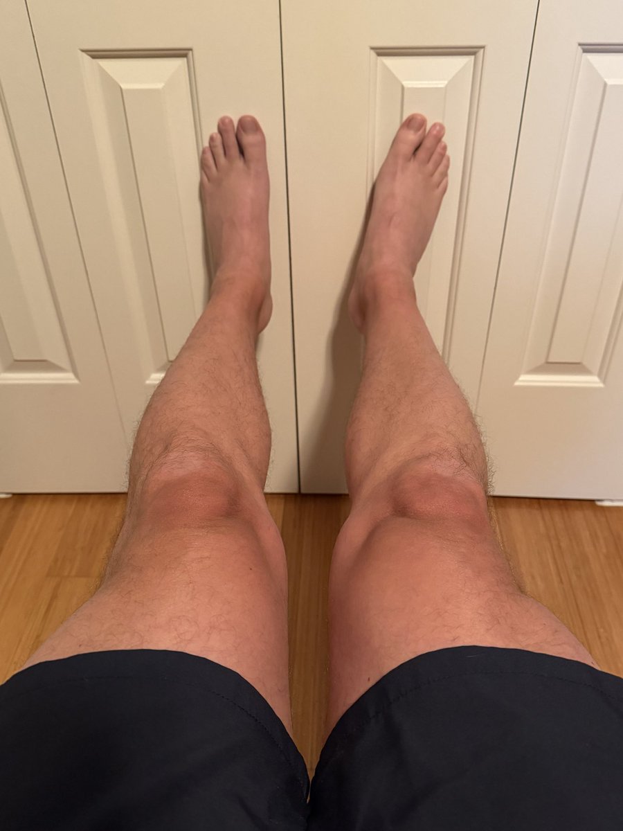 Long legs and big feet 

#bigfeet #bigfoot #size15feet #hugefeet #hugefoot #size15 #size15shoes #tall #tallguy #malefeet #malefootfetish #footdom