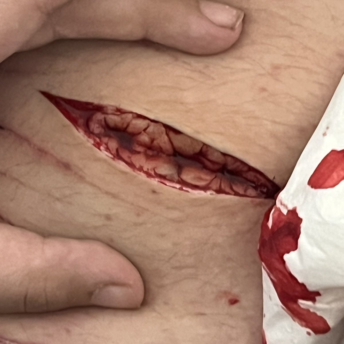 starrypuppyy_'s tweet photo. I LOVE THIS CUT SMMM <33 SMALL SESH :P #shtwt #beanshtwt #beansh #988shtwt #selfharm #SELFHARMTRIGGERWARNING https://t.co/D9b2QOPg6c