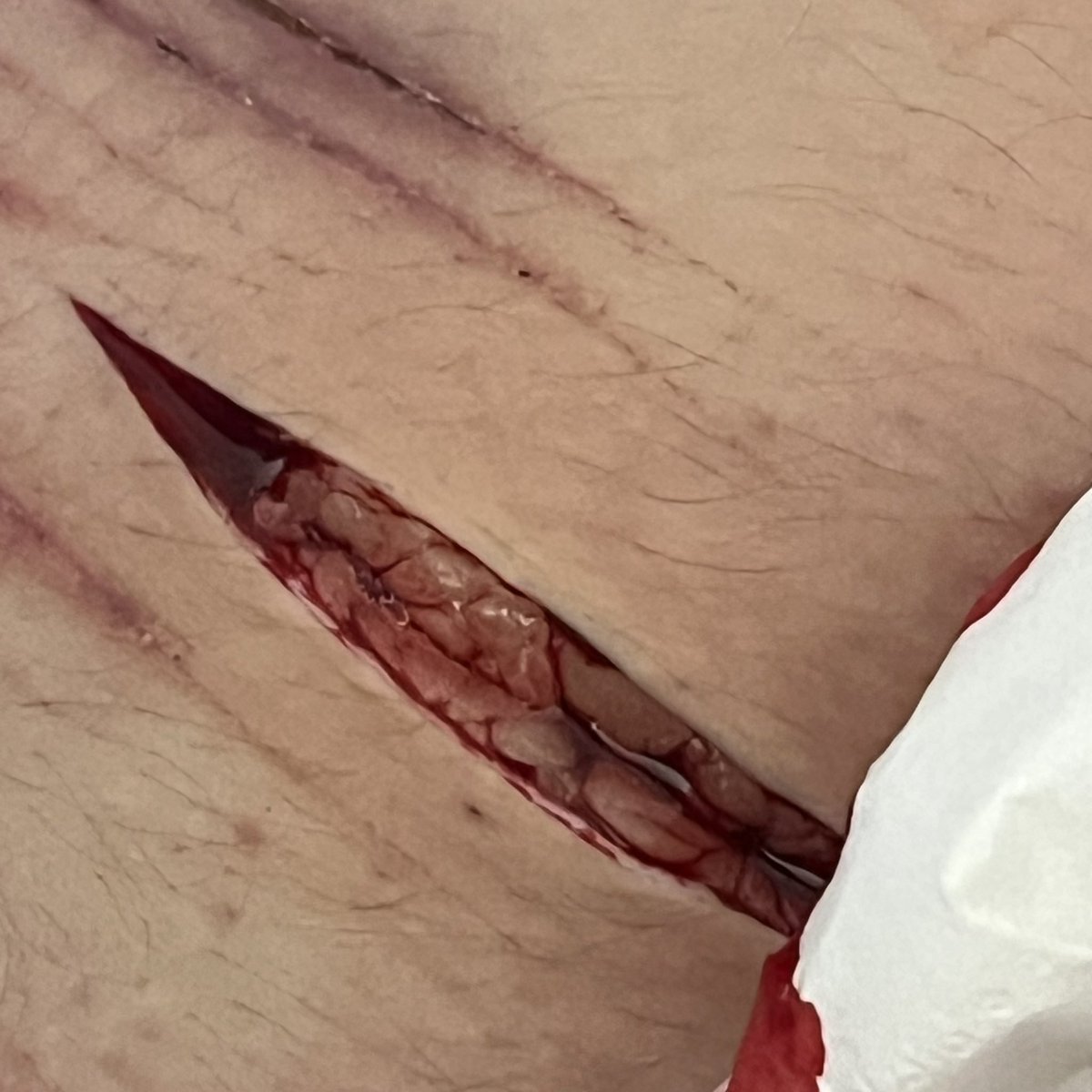 starrypuppyy_'s tweet photo. I LOVE THIS CUT SMMM <33 SMALL SESH :P #shtwt #beanshtwt #beansh #988shtwt #selfharm #SELFHARMTRIGGERWARNING https://t.co/D9b2QOPg6c