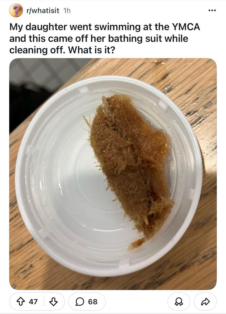 bald ann dowd tweet media