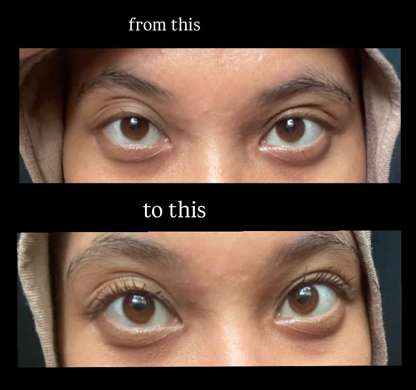 Ririw 🍒 tweet media