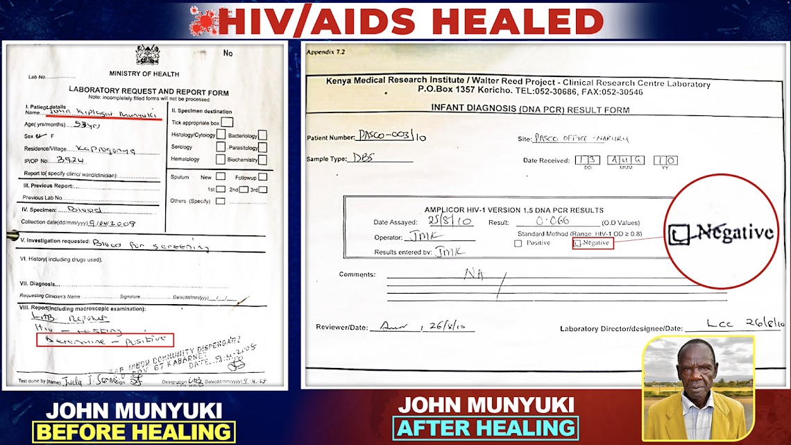 ZadockMutai4's tweet image. The Blood of Jesus has no spatial  limitation, God Heals not one but Several to confound the wisdom of man.
#ScienceBows