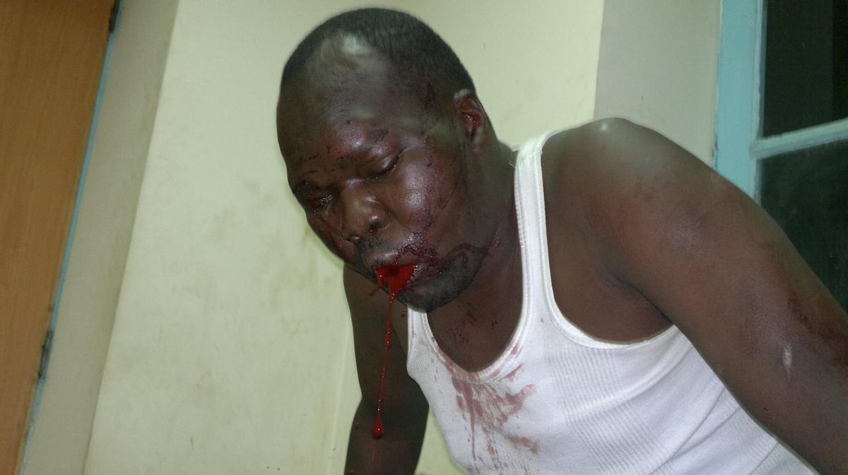 AokoOtieno_'s tweet image. Idiot! 

Makamasi imejaa akili hadi zinatafuta escape route 

Frame 2 was you beaten for swindling Nyayo Estate 

Alai, I worked for you, as Editor, Kahawa Tungu blog. 

I KNOW first hand every EXTORTION you made! 

You know I KNOW YOU 

That's why instead of suing me, you're…